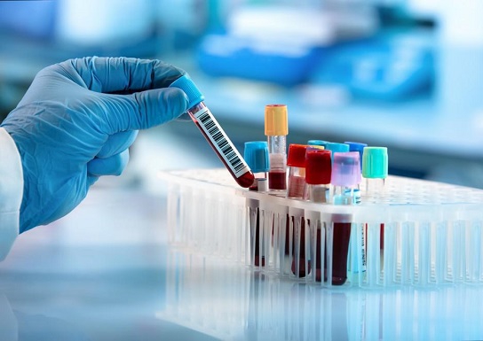 toxicology